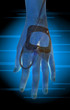 scanning of patients hand and IV solution