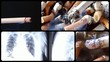 danger of smoking series, four