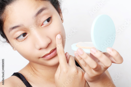 Photo: Teenage And Acne Teenage And Acne