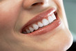 Close up of smiling woman's teeth