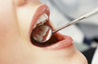 Close up of dentist's angled mirror in woman's mouth