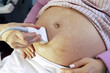 Close up of woman receiving ultrasound