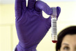 Foto: Close up of pathologist in rubber gloves holding blood sample Close up of pathologist in rubber gloves holding blood sample