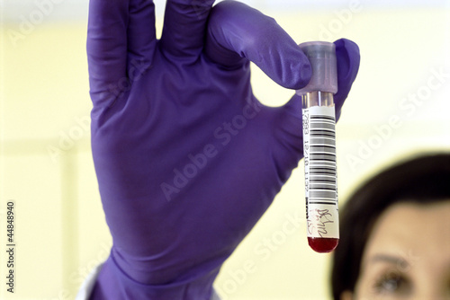 Photo: Close up of pathologist in rubber gloves holding blood sample Close up of pathologist in rubber gloves holding blood sample