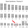 Down syndrome karyotype, eps8