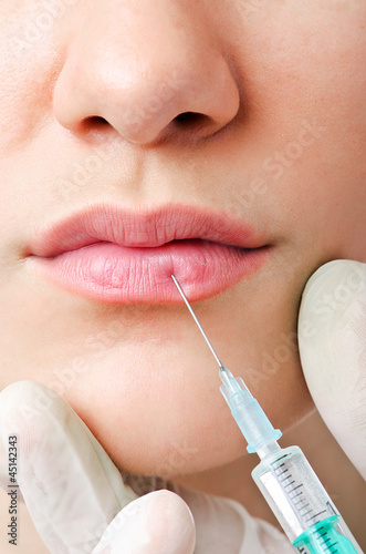 Photo: Woman under the plastic surgery Woman under the plastic surgery