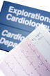 Foto: tracés électrocardiogramme tracés électrocardiogramme
