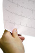 Foto: tracés électrocardiogramme tracés électrocardiogramme