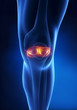 Knee meniscus anatomy anterior view