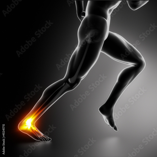 Illustration: Sports ankle and achilles heel injury concept Sports ankle and achilles heel injury concept