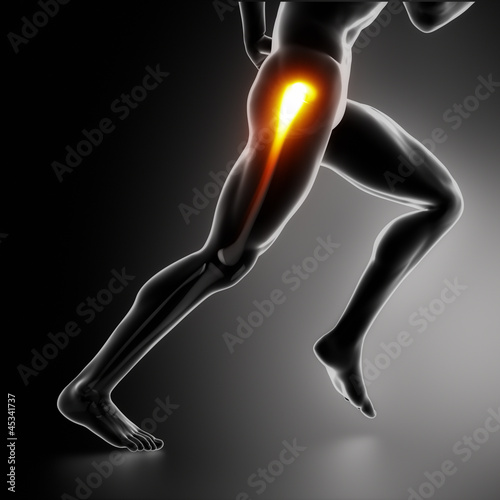 Illustration: Sports hip injury koncept Sports hip injury koncept