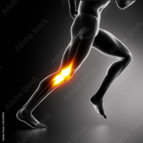 Illustration: Sports Knee pain concept Sports Knee pain concept