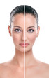 Foto: Before and after - skin Before and after - skin