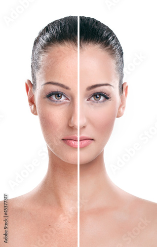 Photo: Before and after - skin Before and after - skin
