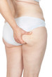 Women's cellulite