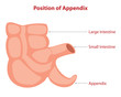 Position of appendix