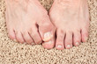 Itchy feet