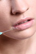 Woman getting an injection in her lips