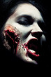 laceration smile