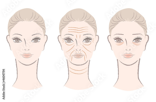 Vector: Beautiful woman getting wrinkles, under-eye bags as she ages Beautiful woman getting wrinkles, under-eye bags as she ages