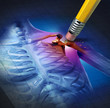 Shoulder Pain Relief