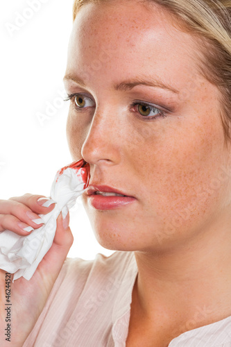 Photo: Frau mit Nasen bluten Frau mit Nasen bluten