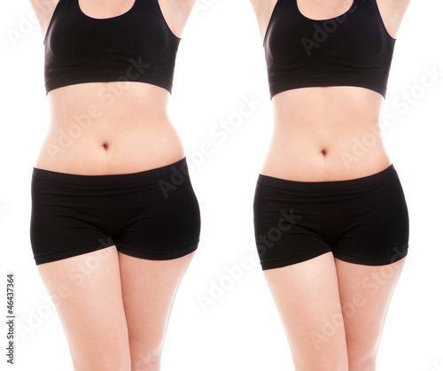 Photo: Woman's body before and after a diet Woman's body before and after a diet