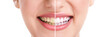 healthy teeth and smile