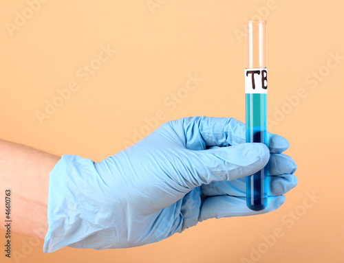 Photo: Test tube labeled Tuberculosis(TB) in hand on beige background Test tube labeled Tuberculosis(TB) in hand on beige background