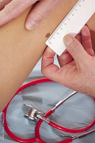 Photo: Dermathologie - Évolution d'un NAEVUS Dermathologie - Évolution d'un NAEVUS