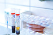 Blood Test