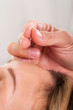 Woman undergoing acupuncture treatment