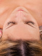Woman undergoing acupuncture treatment