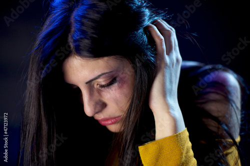 Photo: Eye of beautiful woman with brooses and wound Eye of beautiful woman with brooses and wound