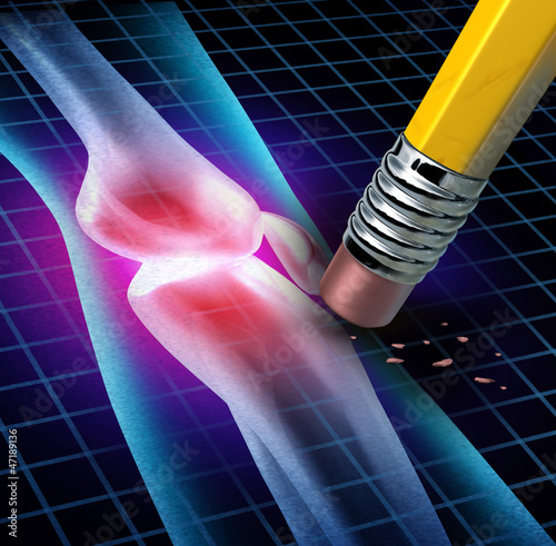 Illustration: Human Knee Pain Relief Human Knee Pain Relief
