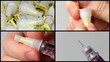 Set: Preparation of needle