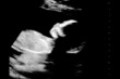 Sonogram