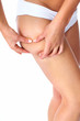 Woman having a cellulite.