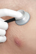 cardiac auscultation
