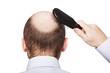 Bald man head