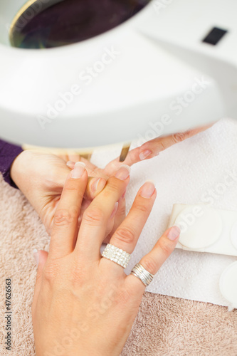 Photo: Cleaned for gel. Cleaned for gel.