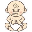 赤ちゃん　発疹