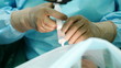 hands of the doctor. instruments for the operation.