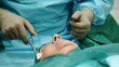 preparation for surgery on the eye.
