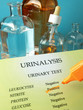 Urine test (urinalysis)