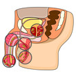 Vector: Diseases of male reproductive system Diseases of male reproductive system