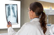 Photo: Woman Doctor Looking at X-Ray Radiography Woman Doctor Looking at X-Ray Radiography