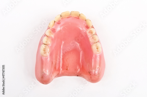 Photo: abgenutzte Oberkieferprothese abgenutzte Oberkieferprothese