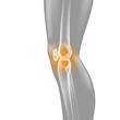 Knie-Schmerzen - Röntgenbild - 3D Grafik