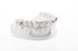 Dental lower jaw